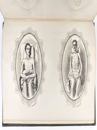 Reports of the Committee on the Conduct of the War: Fort Pillow Massacre | Returned Prisoners