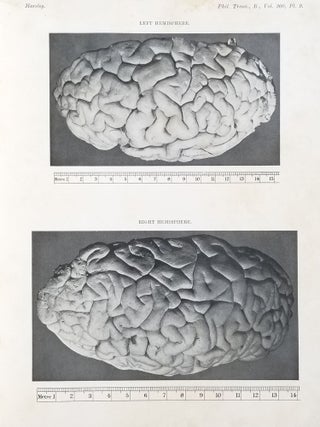 Description of the Brain of Mr. Charles Babbage, F.R.S.