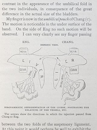 Report on the Autopsy of the Siamese Twins, Together with Other Interesting Information Concerning Their Life